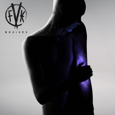 Bruises