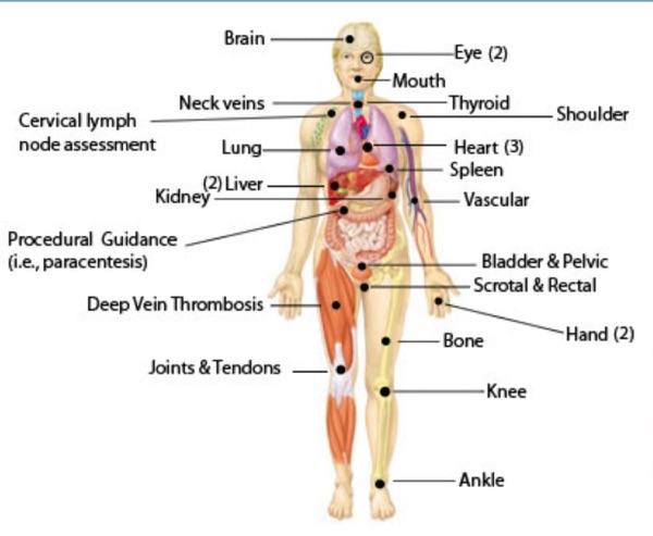 MS1 - Ultrasound in MedEd cover