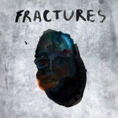 Cadence - Fractures