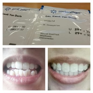 The Perfect Smile
