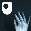 Rheumatoid arthritis - a long term condition - for iPod/iPhone artwork
