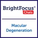 What You Need to Know About Cataracts and Macular Degeneration