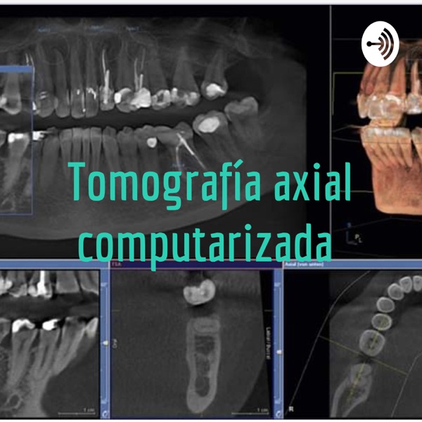 Tomografía axial computarizada