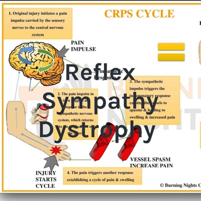Reflex Sympathy Dystrophy : Episode 3