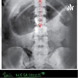 Short concise and history clinching podcast on vasculitis