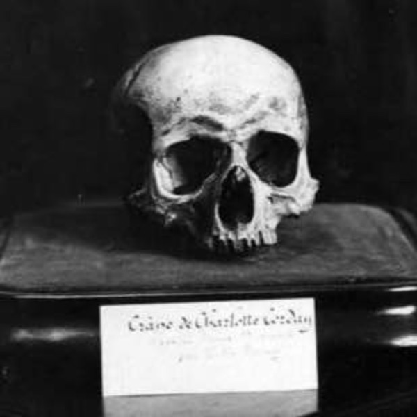 27. Charlotte's Skull (Part 2) photo