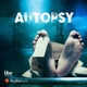 Autopsy