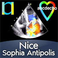 ABC… d'ÉCHOcardiographie podcast