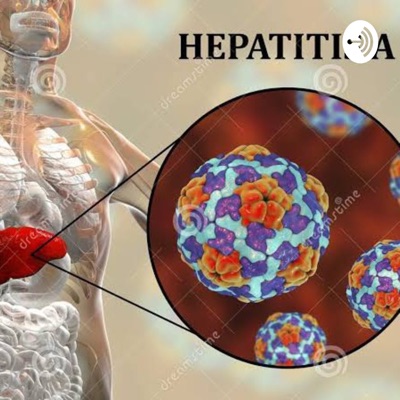 Hepatitis A.