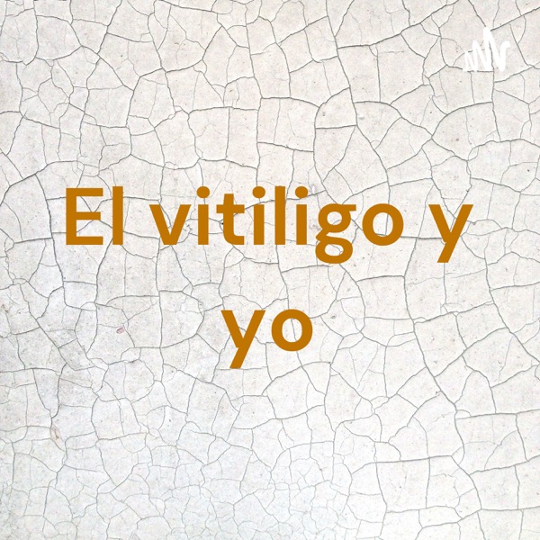 El vitiligo y yo