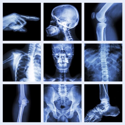 رادیوگرافی فارسی 
Radiography Farsi