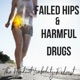 Failed Hips and Harmful Drugs