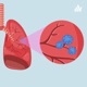 La Relación Entre Ventilación Y Perfusion. 