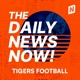 Auburn Tigers Football Today | 2 Min News | The Daily News Now!