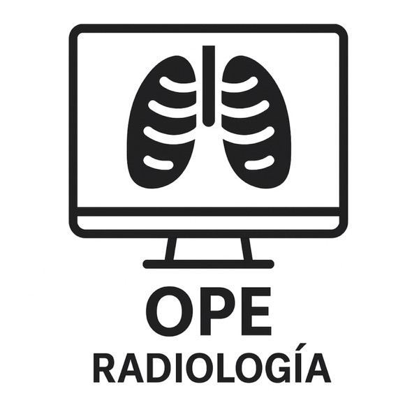 OPE FEA radiodiagnóstico