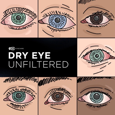 Dry Eye Unfiltered Dry Eye Unfiltered