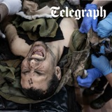 Why Ukraine's troops are facing an amputation crisis