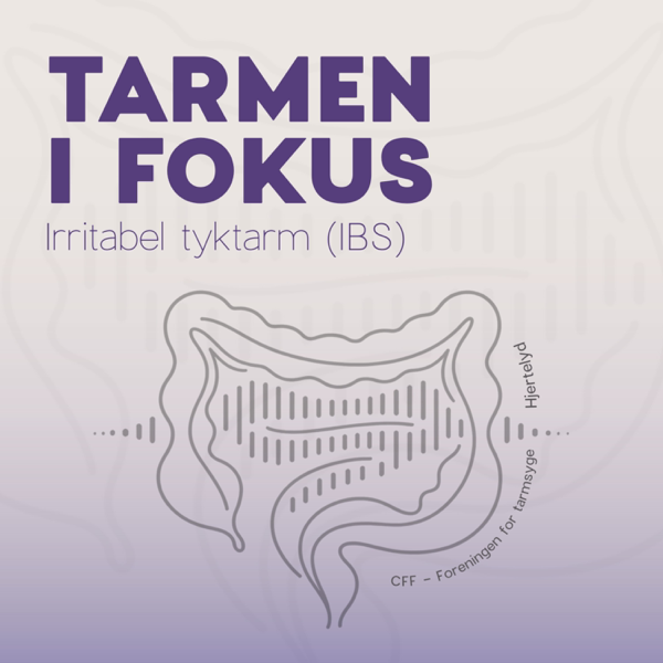 Tarmen i fokus - Irritabel tyktarm af Hjertelyd Podcast