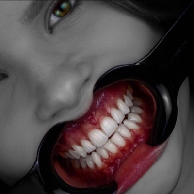 Dentcast Dentcast