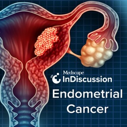 Medscape InDiscussion: Endometrial Cancer