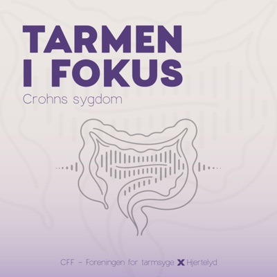 Tarmen i Fokus - Crohns sygdom