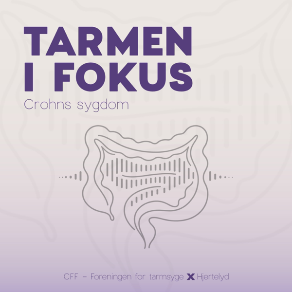 Tarmen i Fokus - Crohns sygdom af Hjertelyd Podcast
