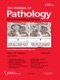 Journal of Pathology - June 2011