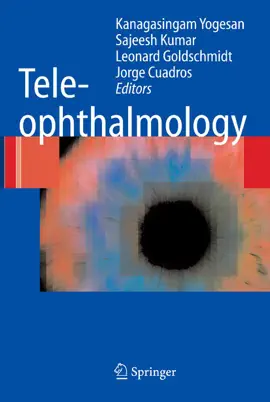 Read: Teleophthalmology