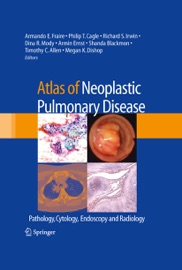 Atlas of Neoplastic Pulmonary Disease - Armando E. Fraire, Philip T. Cagle, Richard S. Irwin, Dina R. Mody, Armin Ernst, Shanda Blackmon, Timothy Craig Allen & Megan K. Dishop