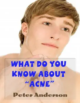 Read: What Do You Know About "Acne" Book