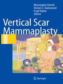 Vertical Scar Mammaplasty - Moustapha Hamdi, Dennis C. Hammond & Foad Nahai