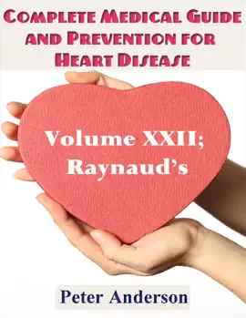 Read: A Complete Medical Guide and Book Prevention for Heart Diseases: Volume XXII; Raynaud's