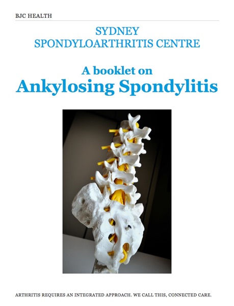 Ankylosing Spondylitis