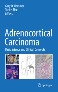 Adrenocortical Carcinoma by Gary D. Hammer & Tobias Else