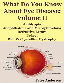 Read: What Do You Know About Eye Disease; Volume II: Amblyopia, Anophthalmia and Microphthalmia, Refractive Book Errors, Behcet and Bietti's Crystalline Dystrophy