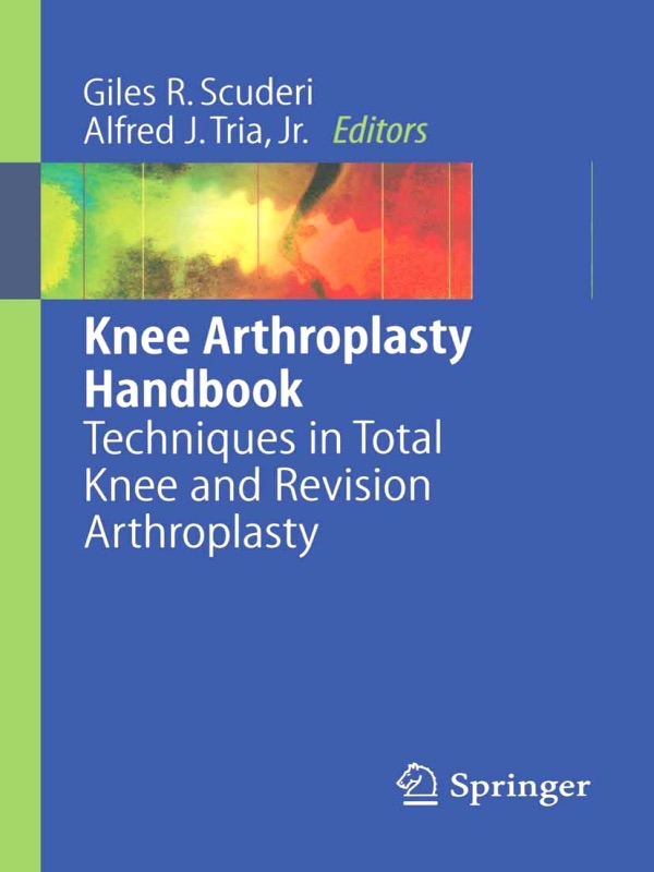 Knee Arthroplasty Handbook cover