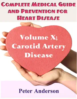 Read: Complete Medical Guide and Prevention for Heart Disease: Volume Book X; Carotid Artery Disease