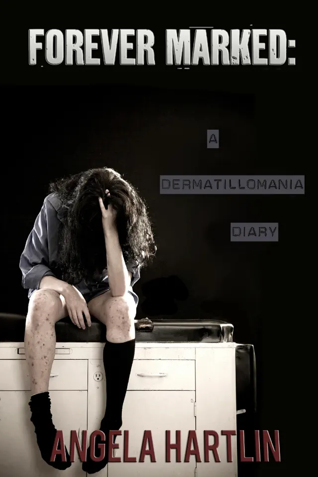 Forever Marked: A Dermatillomania Diary