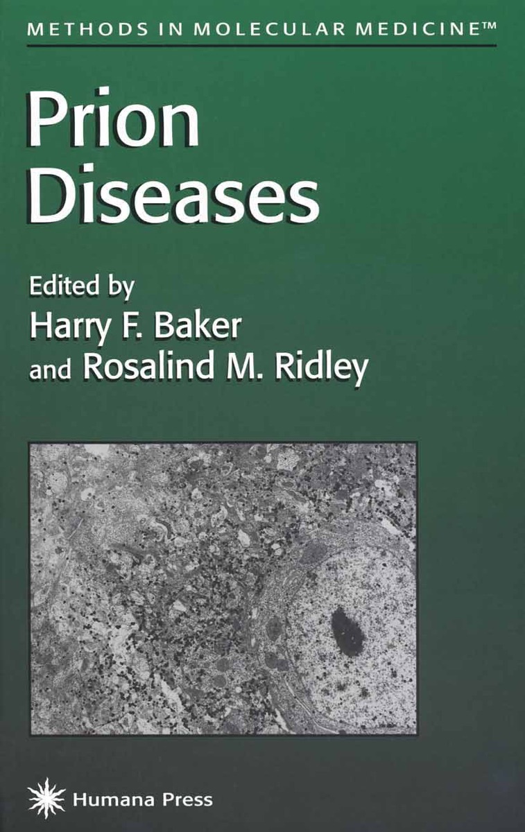 Prion diseases cover