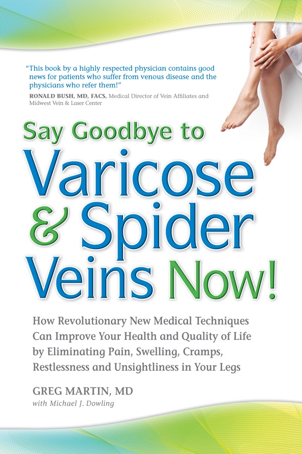 Say goodbye to varicose & spider veins now! cover