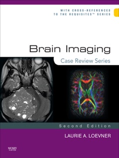 Brain Imaging by Laurie A. Loevner & David M. Yousem
