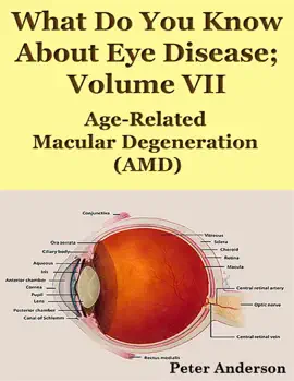 Read: Book What Do You Know About Eye Disease; Volume VII: Age-Related Macular Degeneration (AMD)