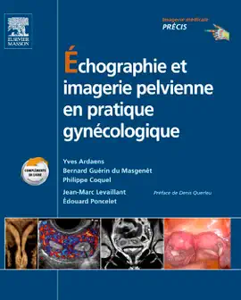Read: Échographie et Book imagerie pelvienne en pratique gynécologique