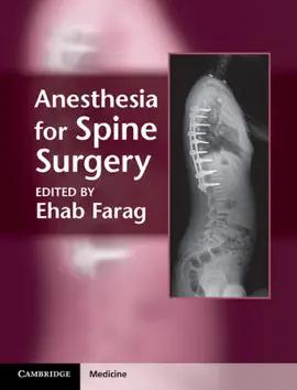 Read: Anesthesia for Spine Book Surgery
