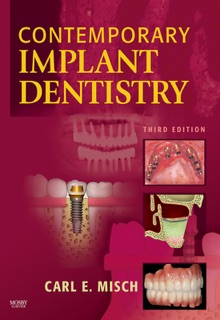 Contemporary Implant Dentistry - E-Book by Carl E. Misch DDS, MDS, PHD(HC)