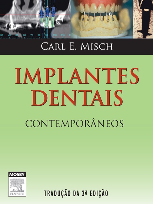 Implantes dentais contemporâneos