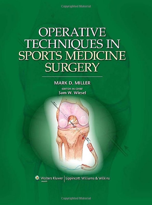 Operative Techniques in Sports Medicine Surgery