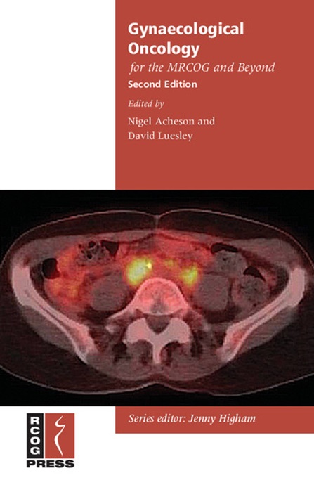 Gynaecological Oncology for the MRCOG and Beyond: Second Edition