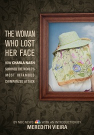 The Woman Who Lost Her Face - NBC News