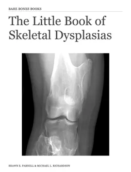Read: The Book Little Book of Skeletal Dysplasias